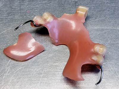 réparation prothèse dentaire à Mettet