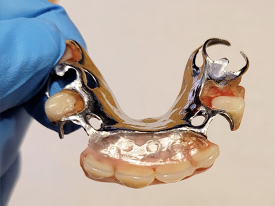 réparation prothèse dentaire à Profondeville