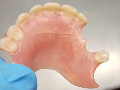 réparation dentier à Mettet