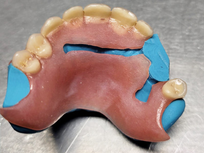 réparation dentier à Fosses-la-Ville